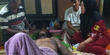 Melepuh Tersiram Air Mendidih, Pedangang Bakso Terima Bantuan dari Ricky Anthony