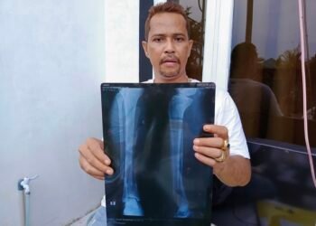 Status Penahanan Tersangka Pembacokan Dialihkan, Korban: Hukum Bisa Dibeli?