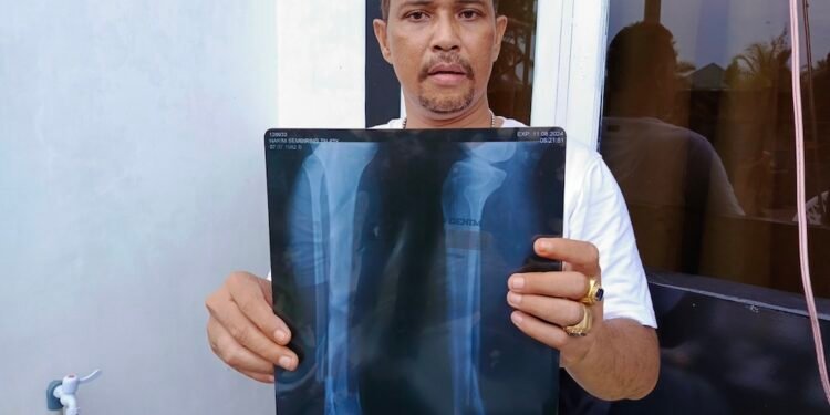 Status Penahanan Tersangka Pembacokan Dialihkan, Korban: Hukum Bisa Dibeli?